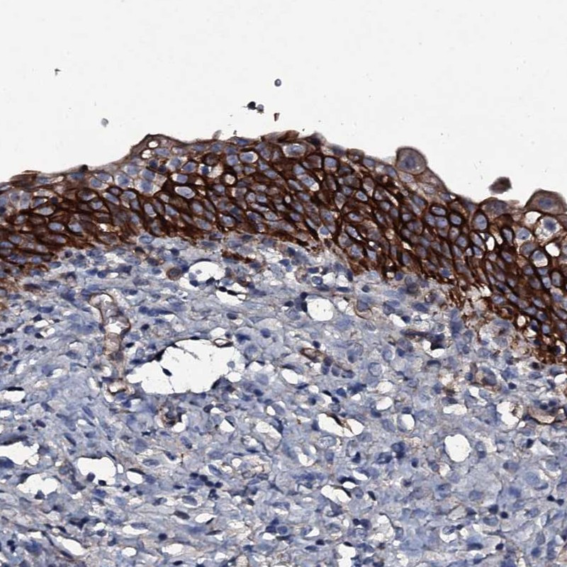 Immunohistochemical staining of human urinary bladder shows strong cytoplasmic and membranous positivity in urothelial cells.