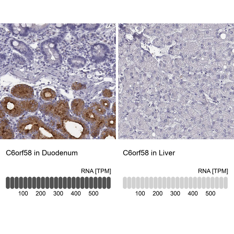 Immunohistochemistry analysis in human duodenum and liver tissues using Anti-C6orf58 antibody. Corresponding C6orf58 RNA-seq data are presented for the same tissues.
