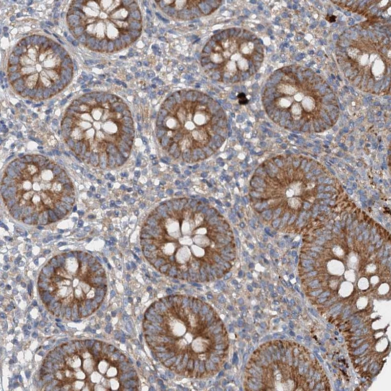 Immunohistochemical staining of human appendix shows moderate cytoplasmic positivity in glandular cells.