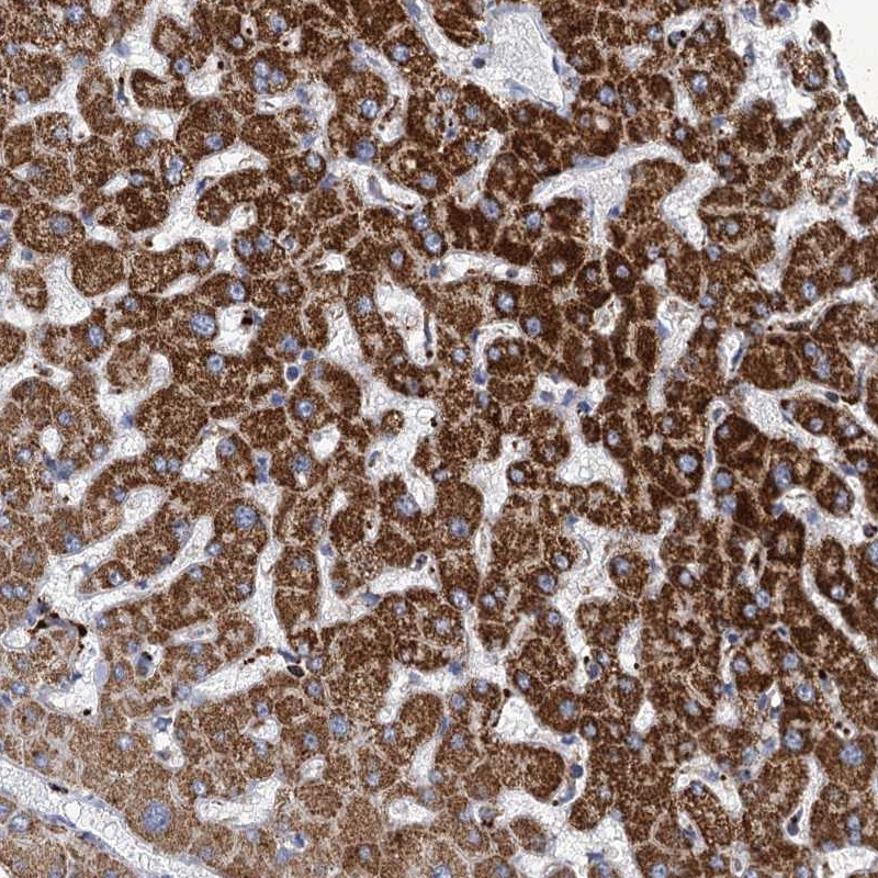 Immunohistochemical staining of human liver shows strong cytoplasmic positivity in hepatocytes.
