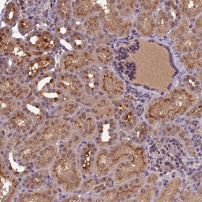Immunohistochemical staining of human kidney shows moderate cytoplasmic and membranous positivity in cells in tubules.