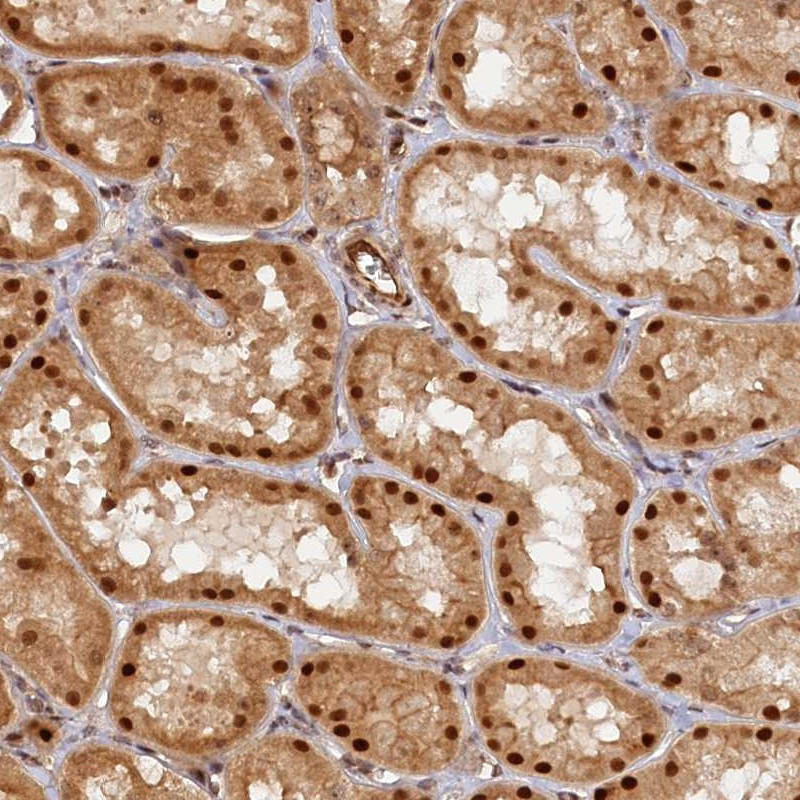 Immunohistochemical staining of human kidney shows nuclear and cytoplasmic positivity in tubular cells.
