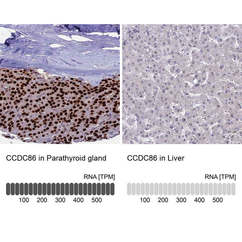 Immunohistochemistry analysis in human parathyroid gland and liver tissues using HPA041540 antibody. Corresponding CCDC86 RNA-seq data are presented for the same tissues.