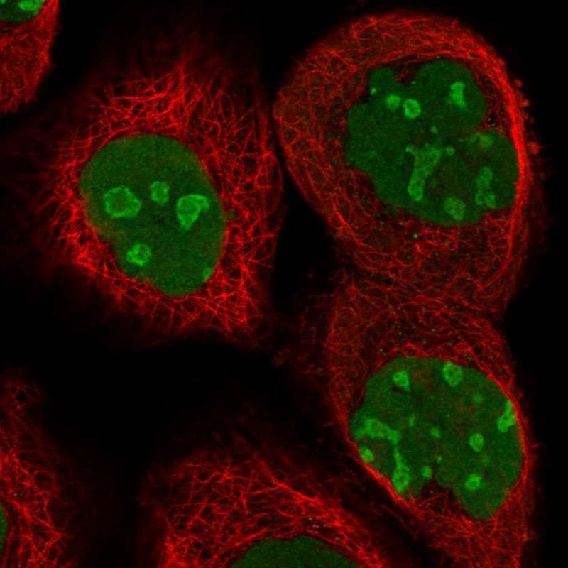 Immunofluorescent staining of human cell line A-431 shows localization to nucleus & nucleoli.