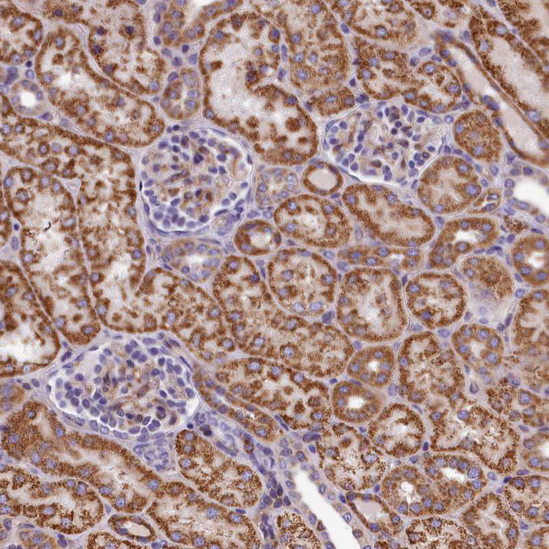 Immunohistochemical staining of human kidney shows strong granular cytoplasmic positivity in cells in tubules.