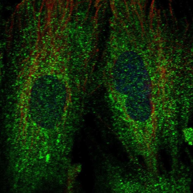 Immunofluorescent staining of human cell line BJ shows localization to cytosol & endoplasmic reticulum.