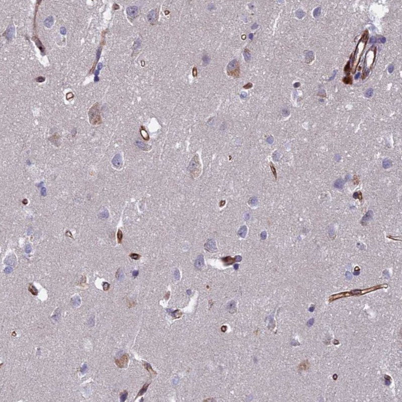 Immunohistochemical staining of human cerebral cortex shows distinct positivity in endothelial cells.