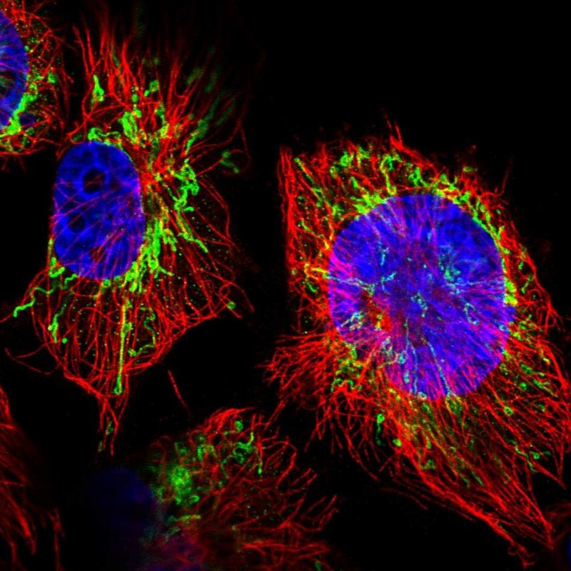 Immunofluorescent staining of human cell line U-251 MG shows localization to mitochondria.