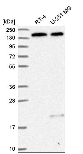 Western blot analysis in human cell line RT-4 and human cell line U-251 MG.