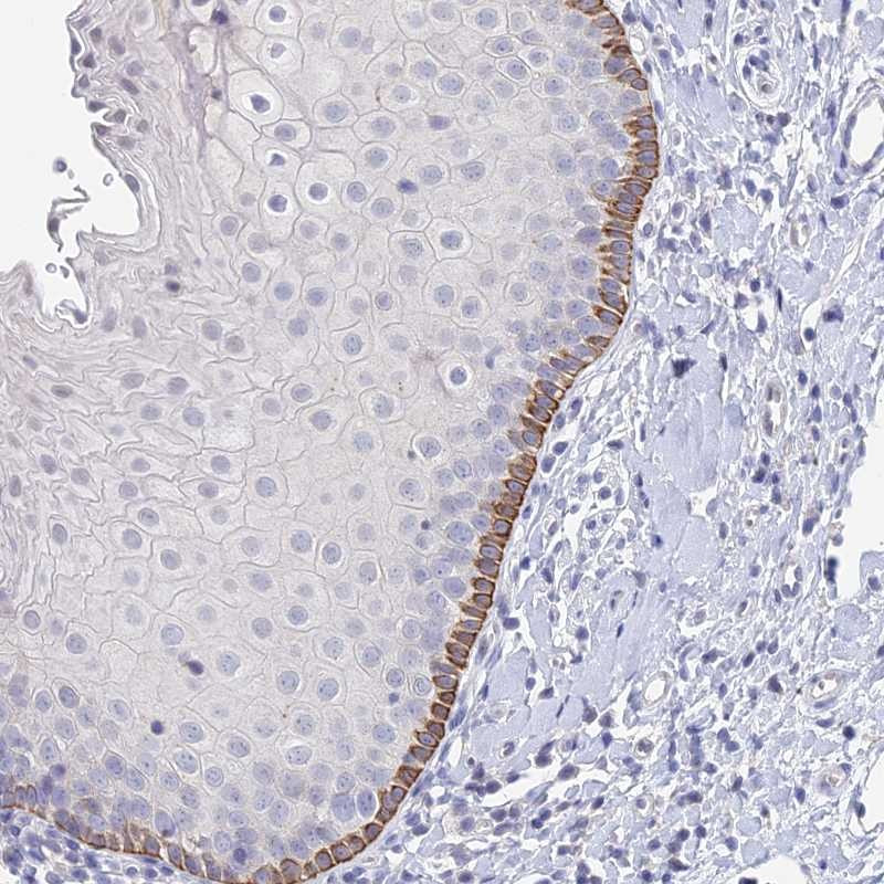 Immunohistochemical staining of human esophagus shows strong cytoplasmic positivity in squamous epithelial cells.