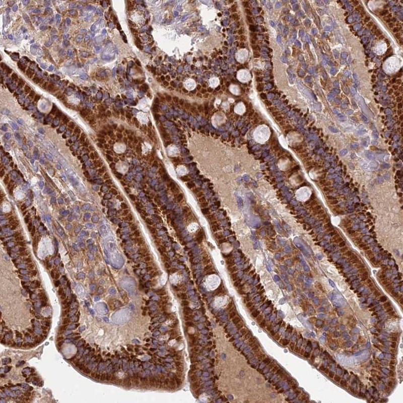 Immunohistochemical staining of human duodenum shows strong cytoplasmic positivity in glandular cells.