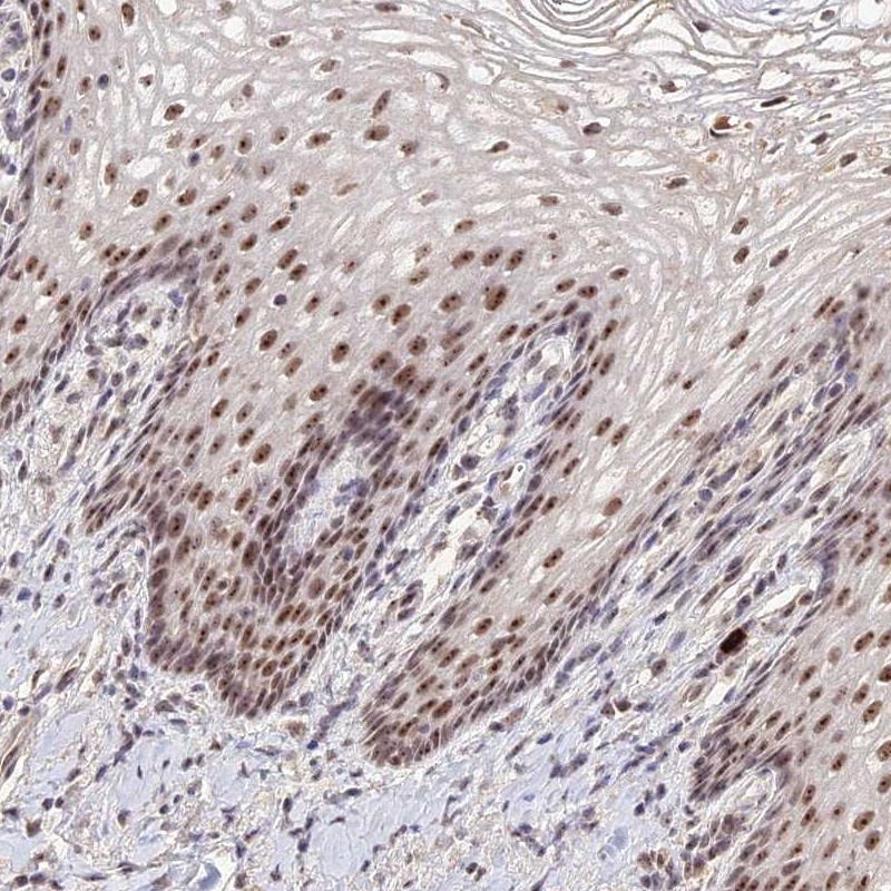 Immunohistochemical staining of human vagina shows moderate nucleolar positivity in squamous epithelial cells.