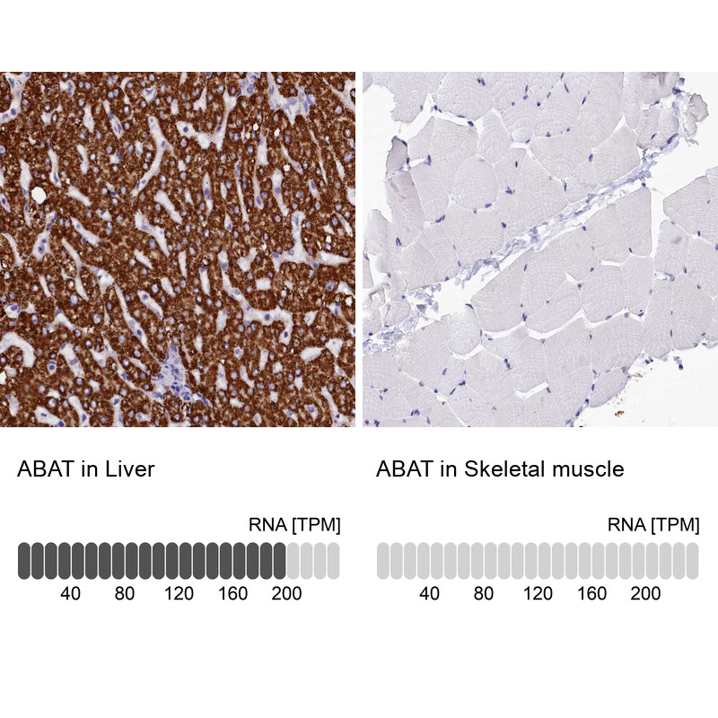 Immunohistochemistry analysis in human liver and skeletal muscle tissues using HPA041690 antibody. Corresponding ABAT RNA-seq data are presented for the same tissues.
