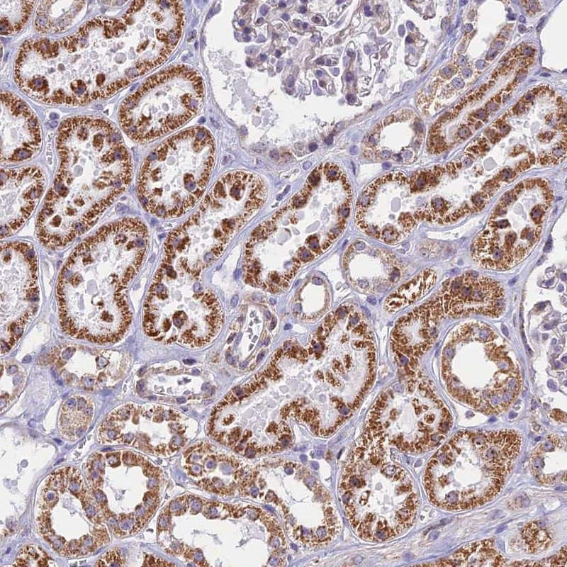 Immunohistochemical staining of human kidney shows strong granular cytoplasmic positivity in cells in tubules.