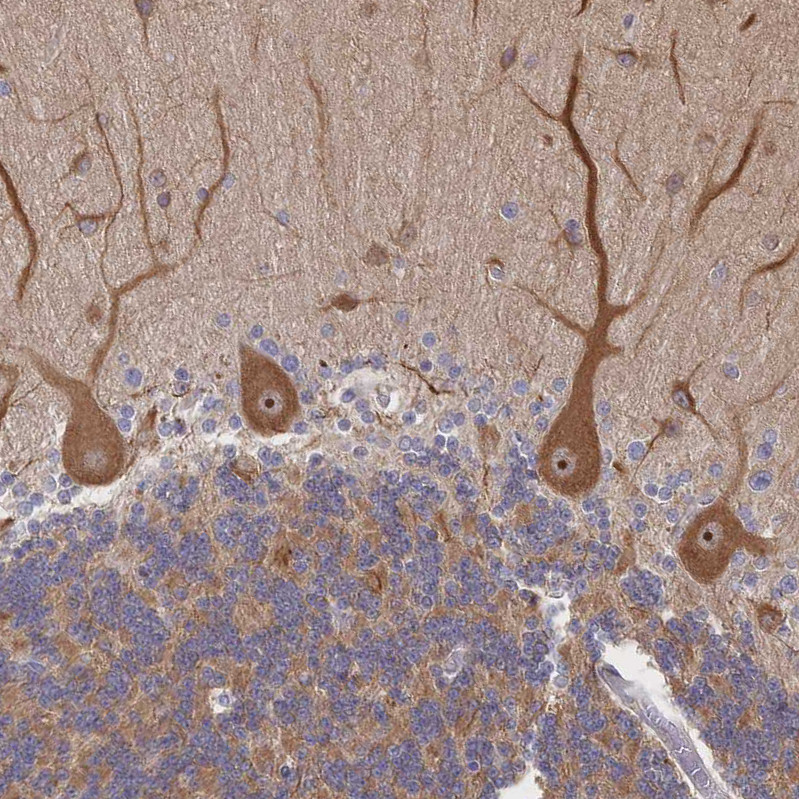 Immunohistochemical staining of human cerebellum shows strong cytoplasmic positivity in Purkinje cells.