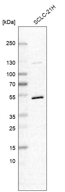 Western blot analysis in human cell line SCLC-21H.