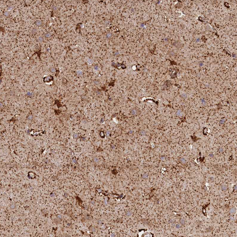 Immunohistochemical staining of human cerebral cortex shows strong cytoplasmic granular positivity in neurons.
