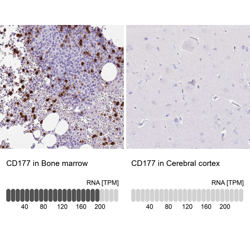 Immunohistochemistry analysis in human bone marrow and cerebral cortex tissues using Anti-CD177 antibody. Corresponding CD177 RNA-seq data are presented for the same tissues.