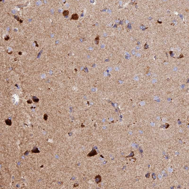 Immunohistochemical staining of human cerebral cortex shows strong cytoplasmic positivity in neuronal cells.