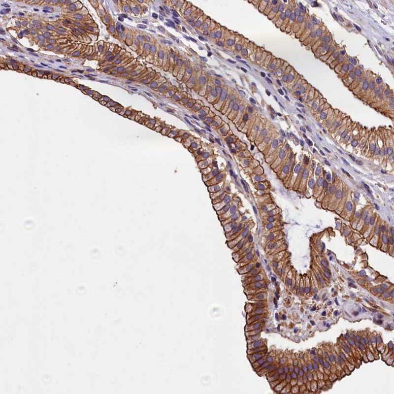 Immunohistochemical staining of human gall bladder shows distinct cytoplasmic and membranous positivity in glandular cells.
