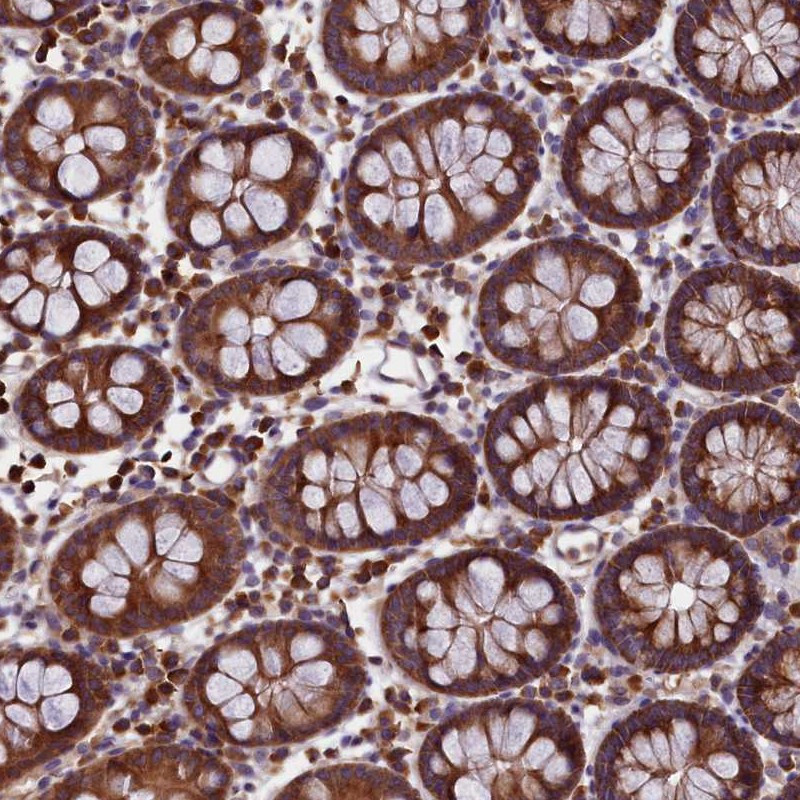 Immunohistochemical staining of human colon shows strong cytoplasmic positivity in glandular cells.
