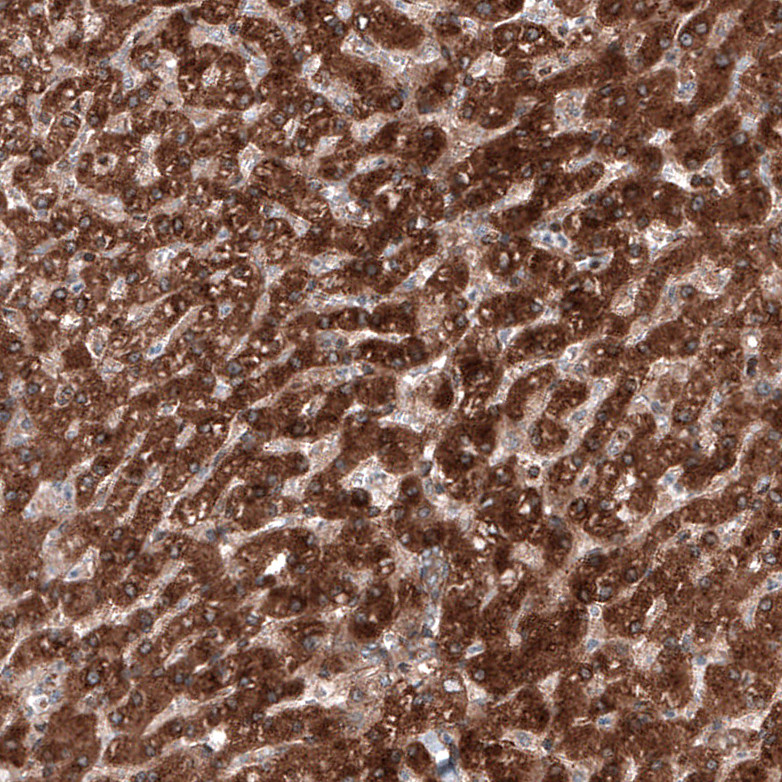 Immunohistochemical staining of human liver shows strong cytoplasmic positivity in hepatocytes.