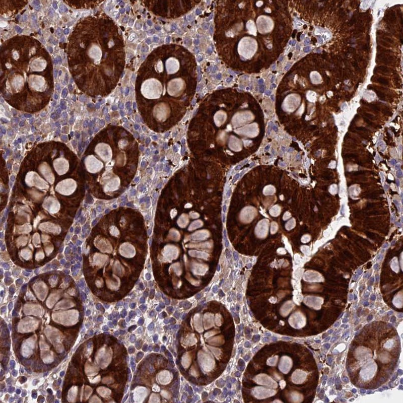 Immunohistochemical staining of human colon shows strong cytoplasmic positivity in glandular cells.