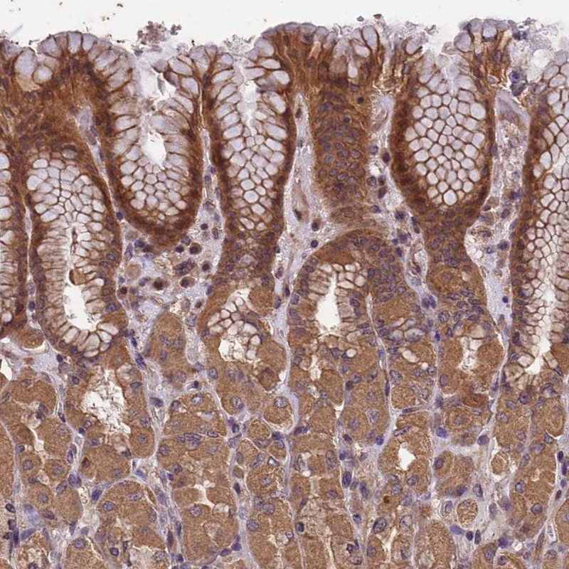 Immunohistochemical staining of human stomach shows moderate cytoplasmic positivity in glandular cells.
