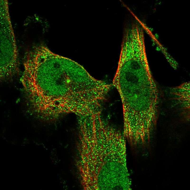 Immunofluorescent staining of human cell line U-251 MG shows localization to nucleoplasm, cytosol & centrosome.
