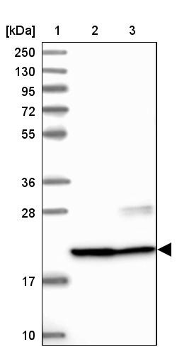 Lane 1: Marker [kDa] 250, 130, 95, 72, 55, 36, 28, 17, 10<br/>Lane 2: Human cell line RT-4<br/>Lane 3: Human cell line U-251MG sp