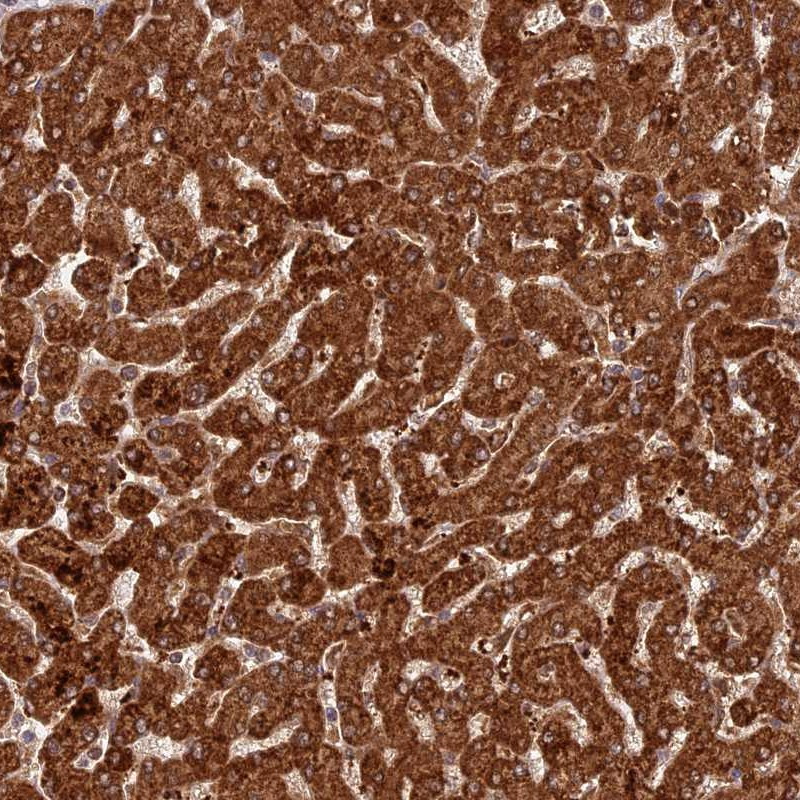 Immunohistochemical staining of human liver shows strong cytoplasmic positivity in hepatocytes.