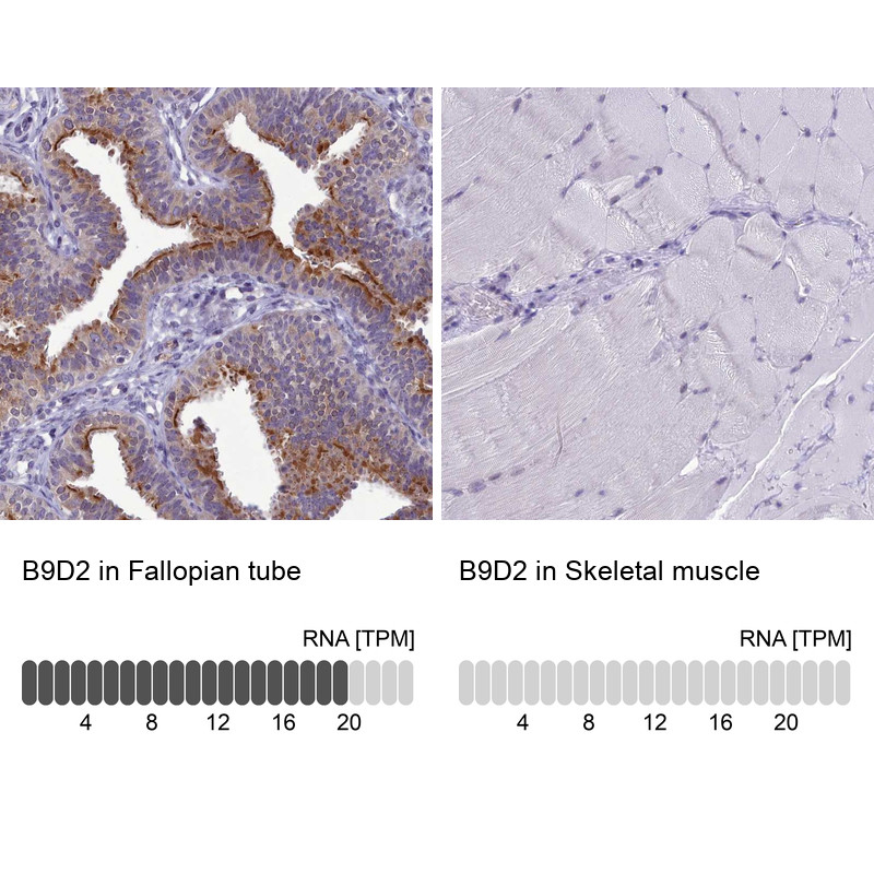 Immunohistochemistry analysis in human fallopian tube and skeletal muscle tissues using Anti-B9D2 antibody. Corresponding B9D2 RNA-seq data are presented for the same tissues.