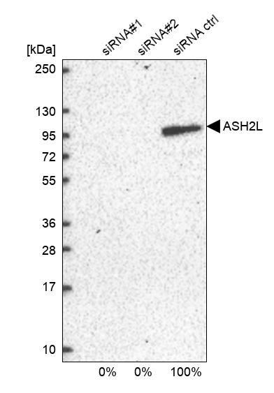 Western blot analysis in U2OS cells transfected with control siRNA, target specific siRNA probe #1 and #2, using Anti-ASH2L antibody. Remaining relative intensity is presented.