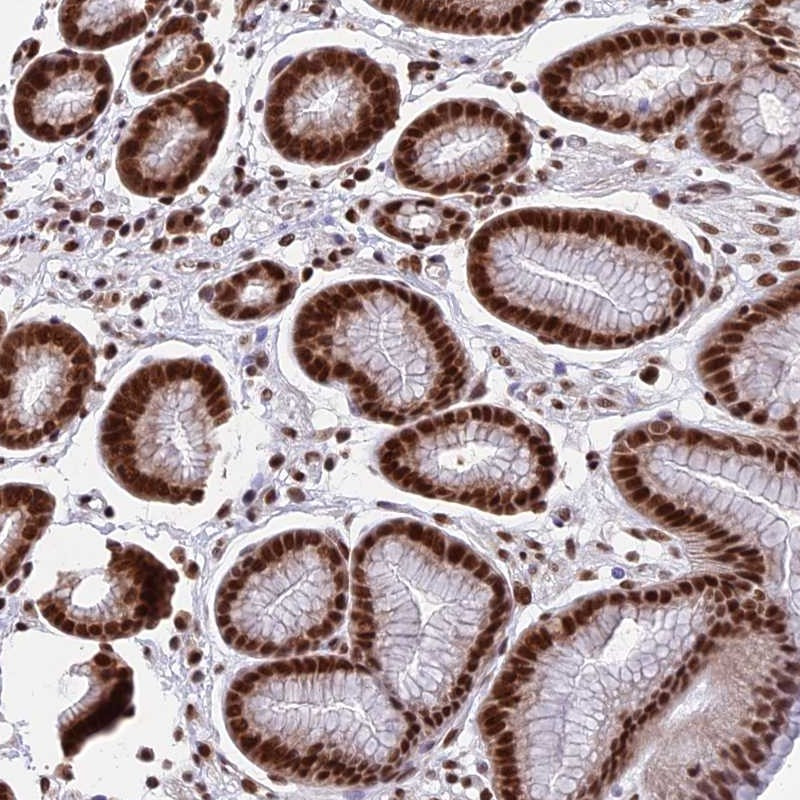 Immunohistochemical staining of human stomach, upper shows strong nuclear positivity in glandular cells.