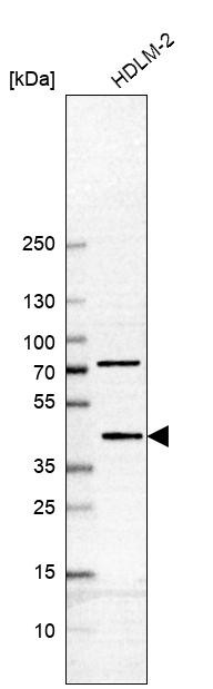 Western blot analysis in human cell line HDLM-2.