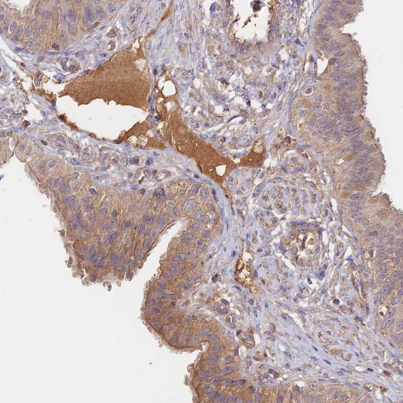 Immunohistochemical staining of human fallopian tube shows moderate positivity in plasma in blood vessels.