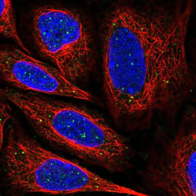 Immunofluorescent staining of human cell line SiHa shows localization to nuclear bodies & vesicles.