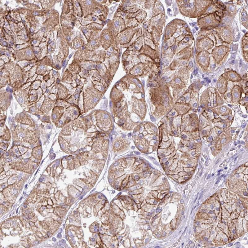 Immunohistochemical staining of human stomach, upper shows strong membranous positivity in subsets of glandular cells.