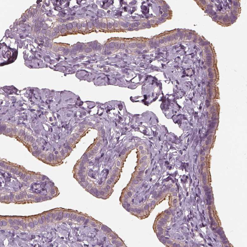 Immunohistochemical staining of human fallopian tube shows strong positivity in cilia in glandular cells.