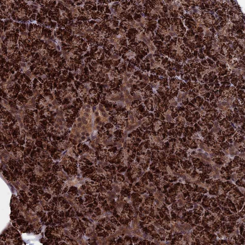 Immunohistochemical staining of human pancreas shows strong cytoplasmic and nuclear positivity in exocrine glandular cells.