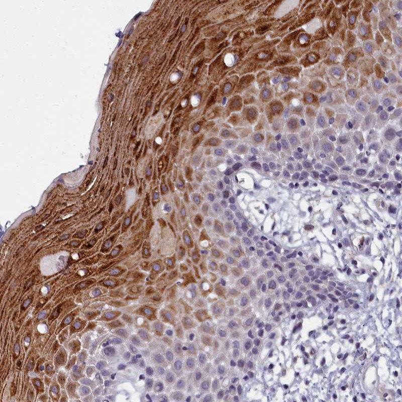 Immunohistochemical staining of human oral mucosa shows strong cytoplasmic positivity in superficial squamous epithelial cells.