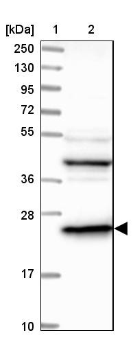 Lane 1: Marker [kDa] 250, 130, 95, 72, 55, 36, 28, 17, 10<br/>Lane 2: Human cell line RT-4