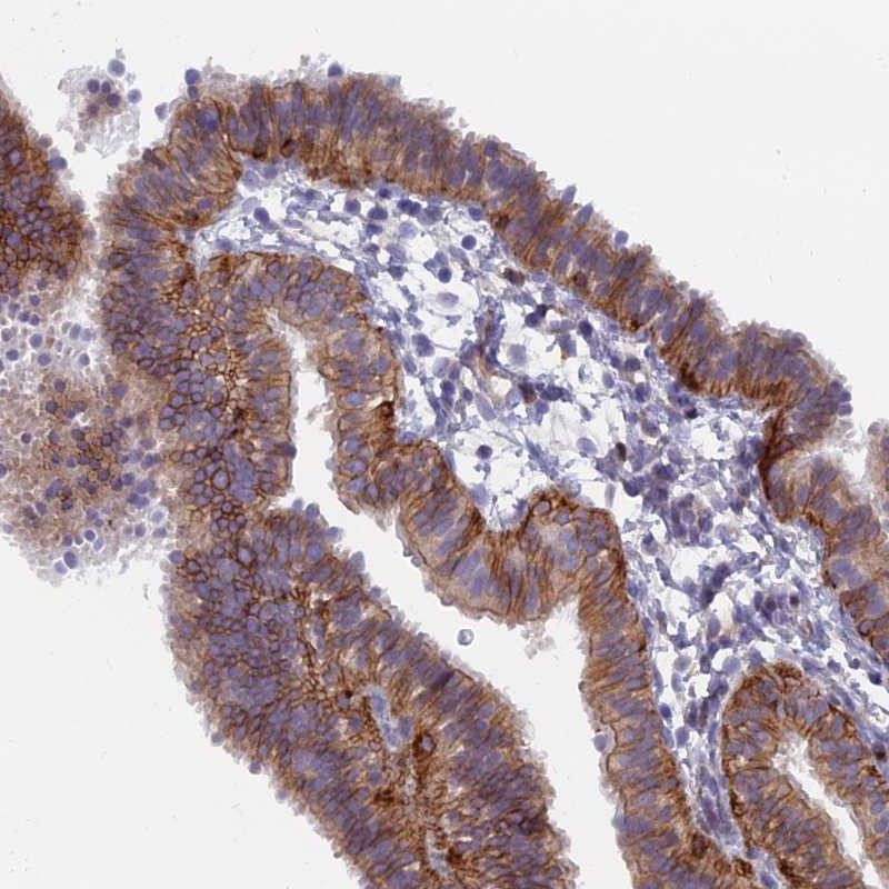 Immunohistochemical staining of human fallopian tube shows distinct positivity in ciliated cells.