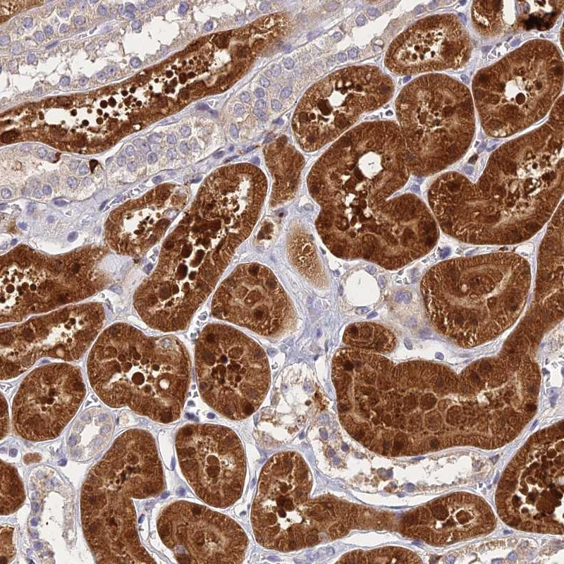 Immunohistochemical staining of human kidney shows strong cytoplasmic and nuclear positivity in renal tubules.