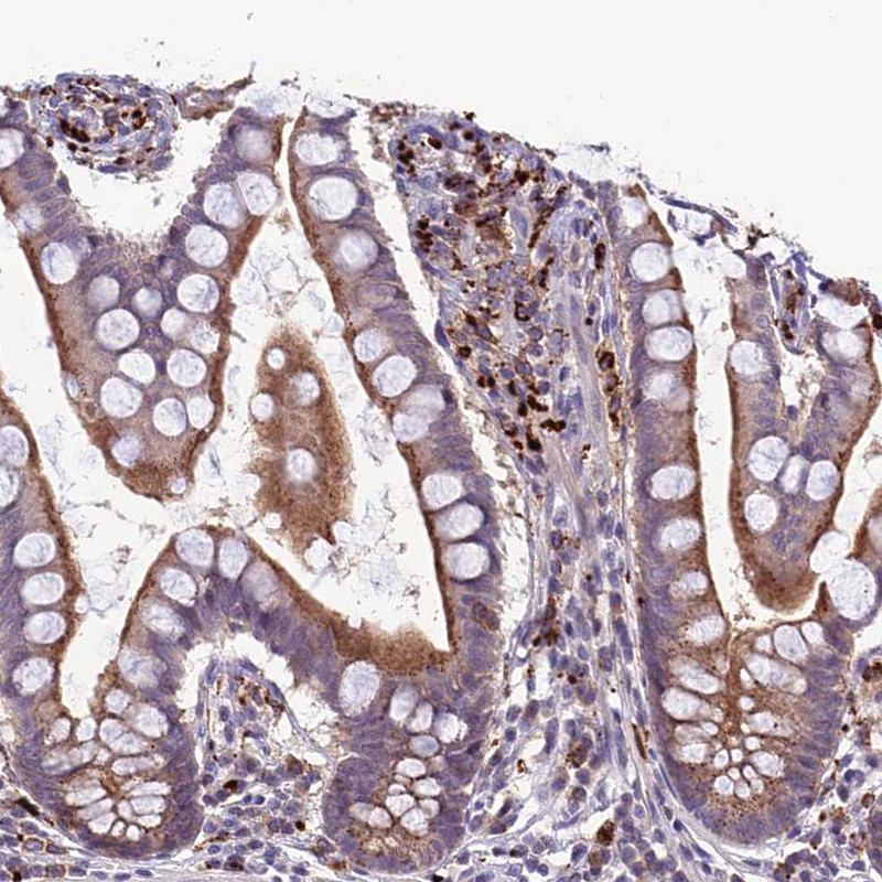 Immunohistochemical staining of human small intestine shows strong cytoplasmic positivity in lymphoid cells.