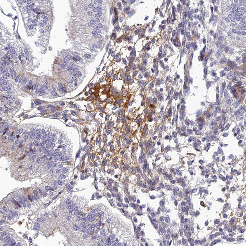 Immunohistochemical staining of human bone marrow shows strong cytoplasmic positivity in hematopoietic cells.