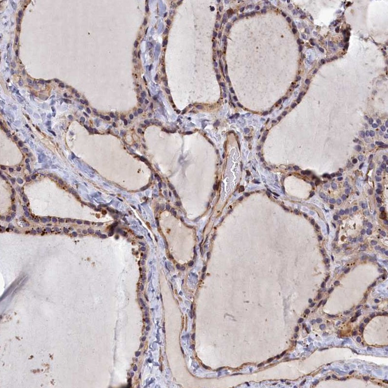 Immunohistochemical staining of human thyroid gland shows cytoplasmic positivity in glandular cells.