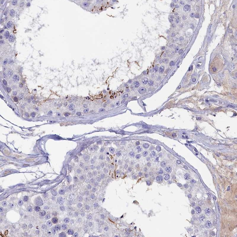 Immunohistochemical staining of human testis shows distinct positivity in spermatids.
