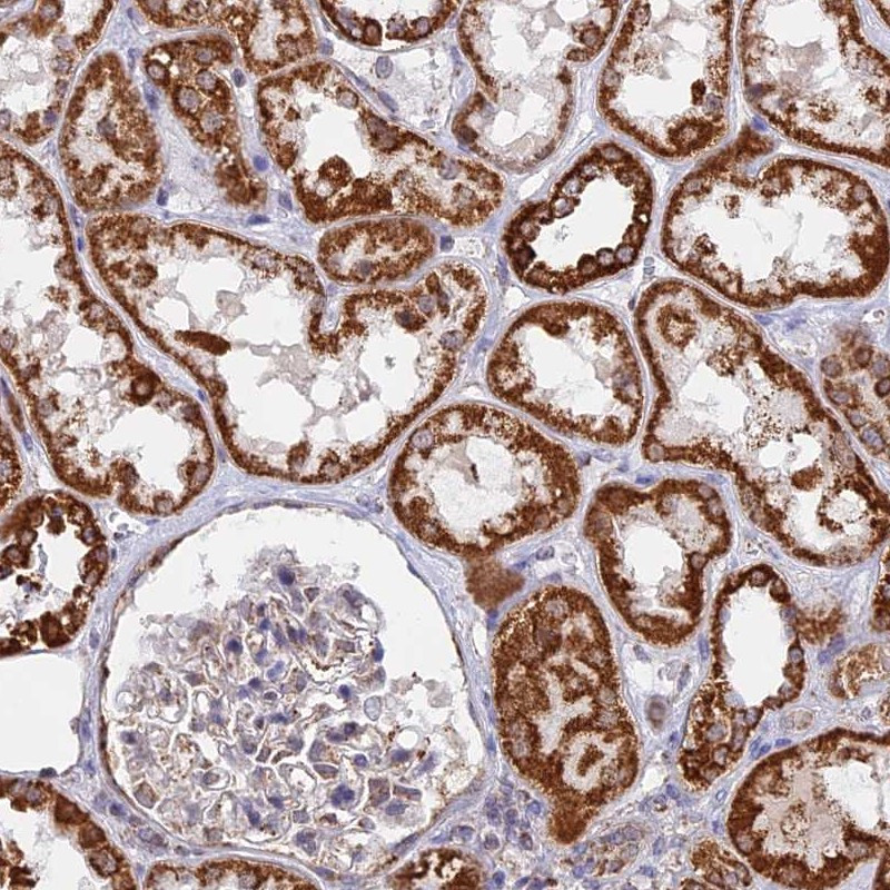 Immunohistochemical staining of human kidney shows strong cytoplasmic positivity in cells in tubules.