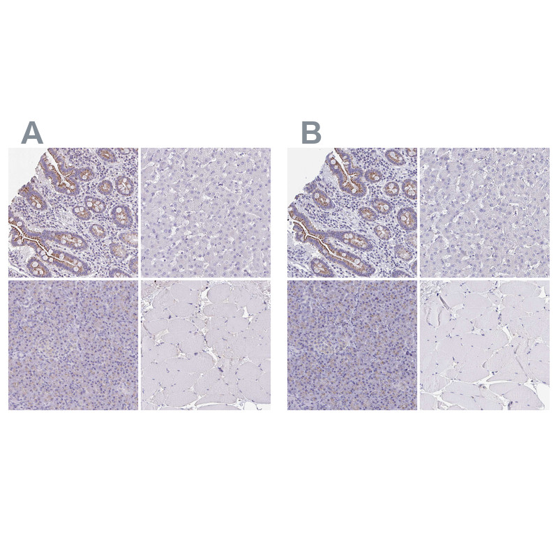 Immunohistochemical staining of human gastrointestinal, liver, pancreas and skeletal muscle using Anti-CHMP5 antibody HPA042883 (A) shows similar protein distribution across tissues to independent antibody HPA056437 (B).